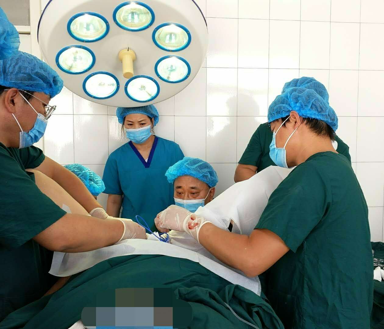 锦州市中心医院马应龙肛肠诊疗中心成功完成巨大直肠腺瘤经肛切除术